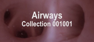 Airways Collection 001001