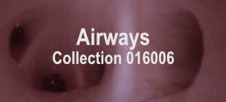 Airways Collection 016006