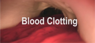 Blood Clotting