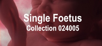 Single Baby Collection 024005