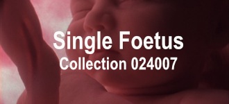 Single Baby Collection 024007