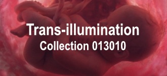 Trans-illumination 36 Collection 013010