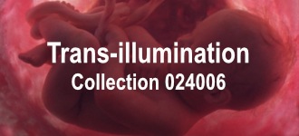 Trans-illumination 36 Collection 024006