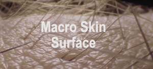 Macro Skin
