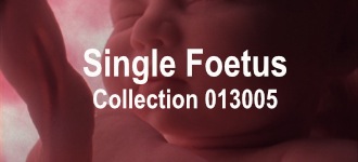 Single Baby Collection 013005